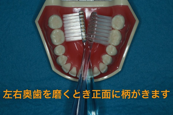 写真11：下の歯を噛む面から見た写真