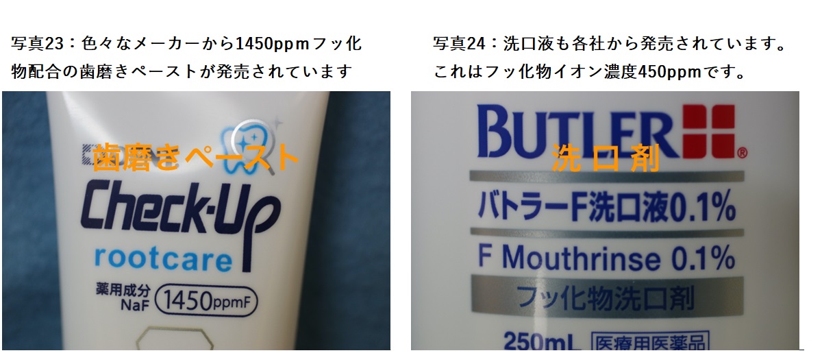 写真23：1450ppｍフッ化物配合の歯磨きペースト（例）写真24：洗口液（例）フッ素450PPM